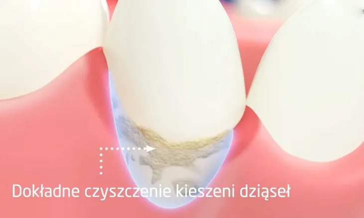 zestaw-cleanyteeth-rose-gold-tryby-pracy-codzienne-czyszczenie-dokladne-czyszczenie-pielegnacja-dziasel-wybielanie-czyszczenie-jezyka-glebokie-czyszczenie-delikatne-czyszczenie-profesjonalne-czyszczenie