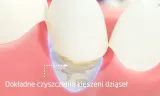 zestaw-cleanyteeth-rose-gold-tryby-pracy-codzienne-czyszczenie-dokladne-czyszczenie-pielegnacja-dziasel-wybielanie-czyszczenie-jezyka-glebokie-czyszczenie-delikatne-czyszczenie-profesjonalne-czyszczenie