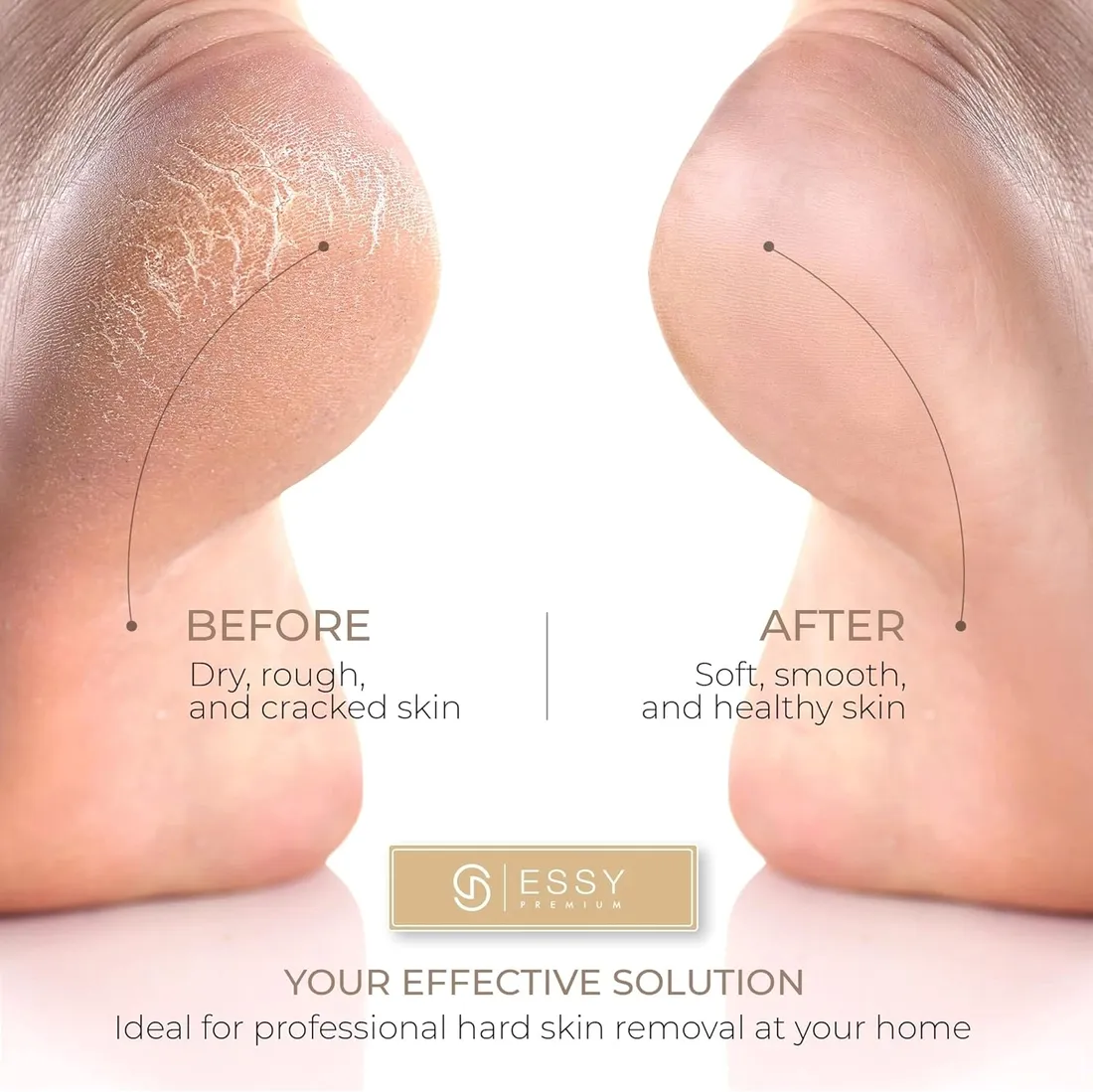 essy-elektryczny-pilnik-do-stop-5-rolek-usuwanie-zrogowacen