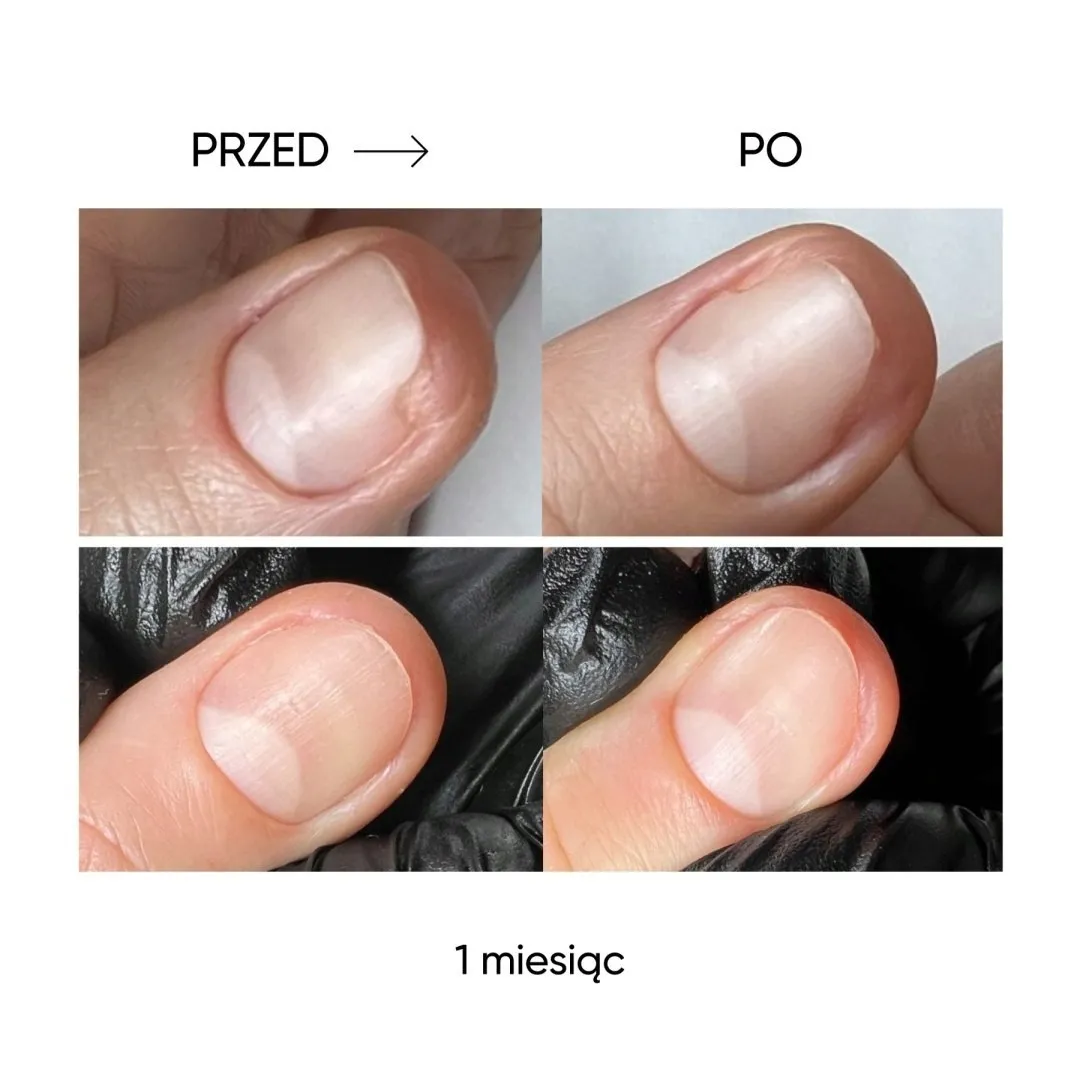 nailsoftheday-podology-onistop-15-ml