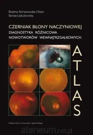 czerniak-blony-naczyniowej-diagnostyka-roznicowa-bozena-romanowska-dixon