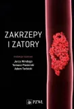 zakrzepy-i-zatory