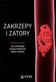 zakrzepy-i-zatory