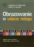 obrazowanie-w-udarze-mozgu
