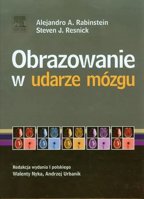 obrazowanie-w-udarze-mozgu