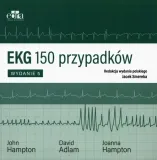 ekg-150-przypadkow