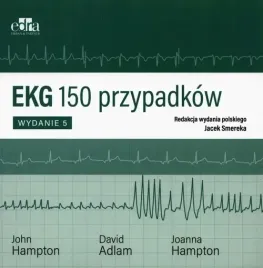 ekg-150-przypadkow
