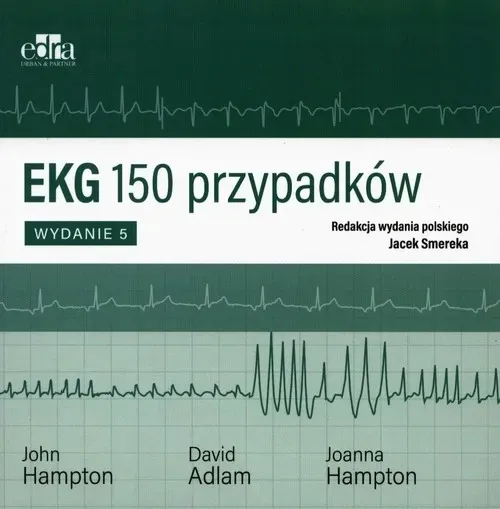 ekg-150-przypadkow
