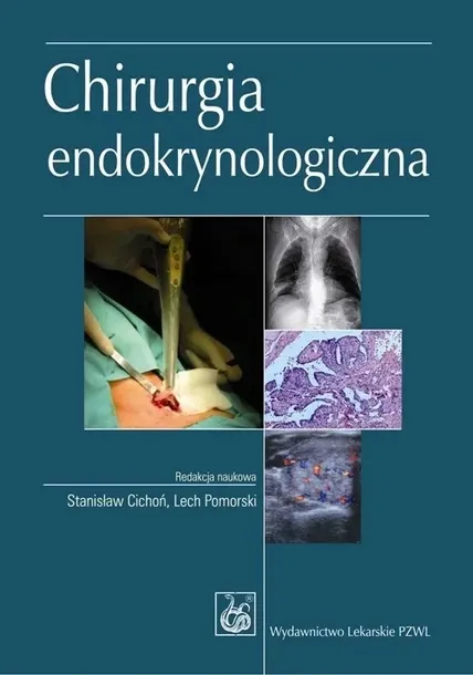 chirurgia-endokrynologiczna