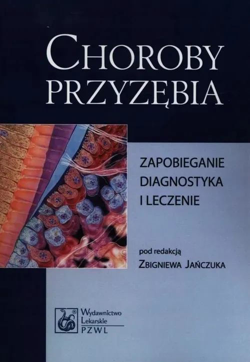 choroby-przyzebia