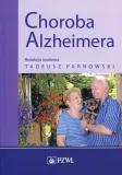 choroba-alzheimera