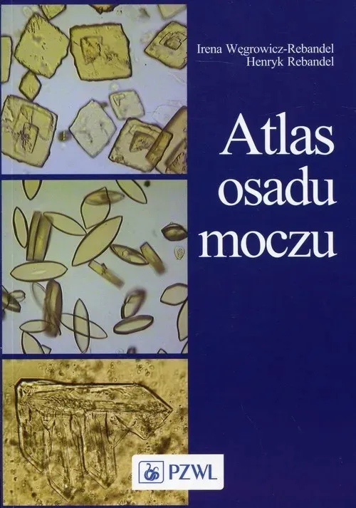 atlas-osadu-moczu