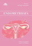 endometrioza