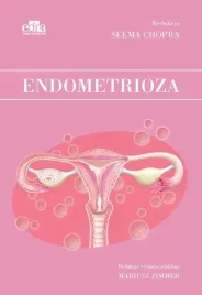 endometrioza