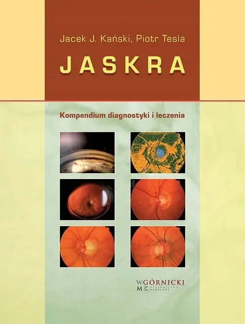 jaskra