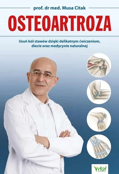 osteoartroza