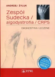 zespol-sudecka-algodystrofia-crps