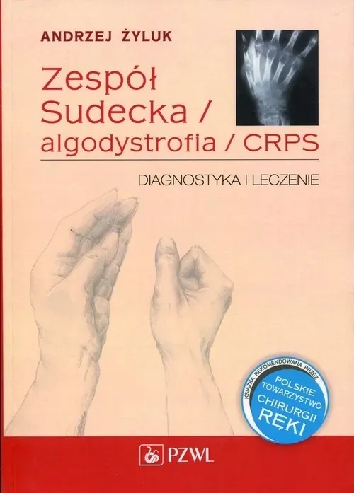 zespol-sudecka-algodystrofia-crps