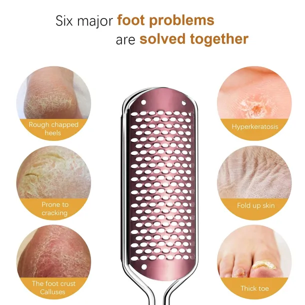 pilnik-do-stop-pedicure-duzy-tarnik-do-stop-stan-nowy-rodzaj-tarka