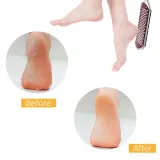 pilnik-do-stop-pedicure-duzy-tarnik-do-stop-stan-nowy-kod-producenta-n-a