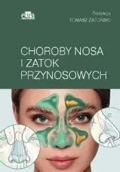 oct-i-octa-w-chorobach-siatkowki