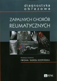 diagnostyka-obrazowa-zapalnych-chorob