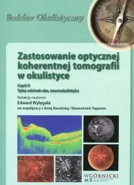 zastosowanie-optycznej-koherentnej-tomografii-cz-2
