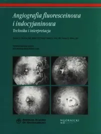 angiografia-fluoresceinowa-i-indocyjaninowa