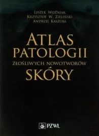 atlas-patologii-zlosliwych-nowotworow-skory