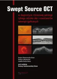 swept-source-oct-w-diagnostyce-patologii-tylnego