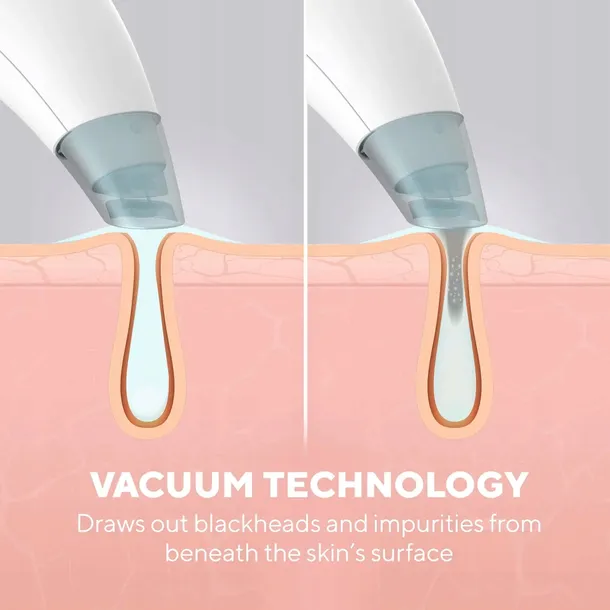 hydradermabrazja-refresh-homedics-fac-hy100-kod-producenta-fac-hy100