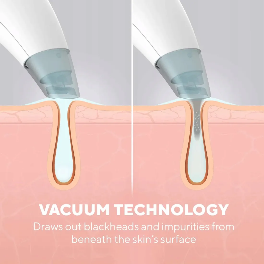 hydradermabrazja-refresh-homedics-fac-hy100-stan-nowy