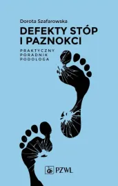 defekty-stop-i-paznokci-praktyczny-poradnik-podol