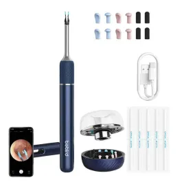 otoskop-bebird-note-5-pro-niebieski