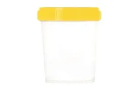 pojemnik-sterylny-na-mocz-100ml