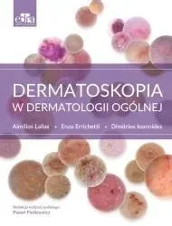 dermatoskopia-w-dermatologii-ogolnej