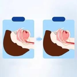 szyna-wkladka-przeciw-chrapaniu-ochrona-zebow-nastawny