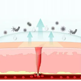 oddychajacy-i-wodoodporny-hydrokoloid-odpowiedni-do-pielegnacji-ran