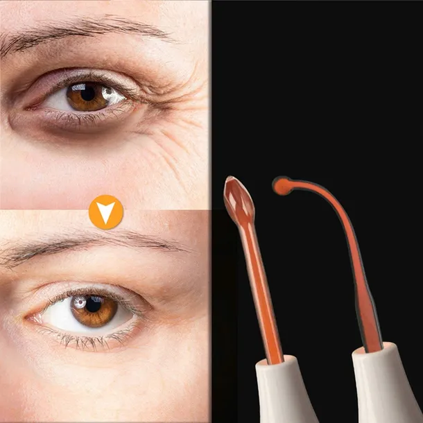 darsonval-retoo-u035-10-w-model-u035