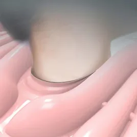 nadmuchiwana-umywalka-do-mycia-wlosow-do-lozka-dla-osob-obloznie-chorych