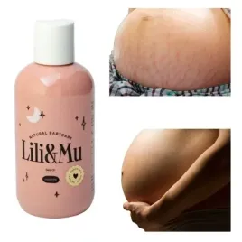 naturalny-olejek-na-rozstepy-dla-kobiet-w-ciazy-pielegnacja-prezent