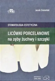 licowki-porcelanowe-na-zeby-zuchwy-i-szczeki-jacek-ciesielski