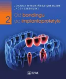 od-bondingu-do-implantoprotetyki-cz-2