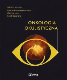 onkologia-okulistyczna