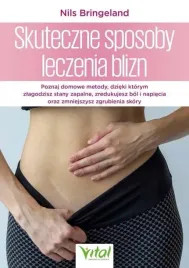 skuteczne-sposoby-leczenia-blizn-nils-bringeland