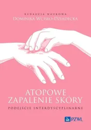 atopowe-zapalenie-skory-podejscie-interdyscyplina