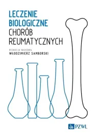 leczenie-biologiczne-chorob-reumatycznych