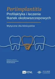 periimplantitis-profilaktyka-i-leczenie-tkanek
