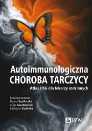 autoimmunologiczna-choroba-tarczycy-atlas-usg