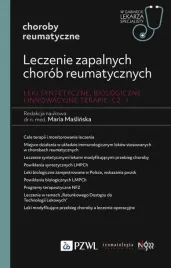 leczenie-zapalnych-chorob-reumatycznych